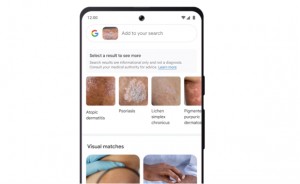 Google-Lends-Skin-Search-01